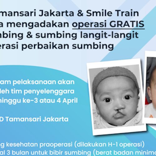 Catat! RSUD Taman Sari Jakarta Gelar Operasi Bibir Sumbing Gratis di Bulan April