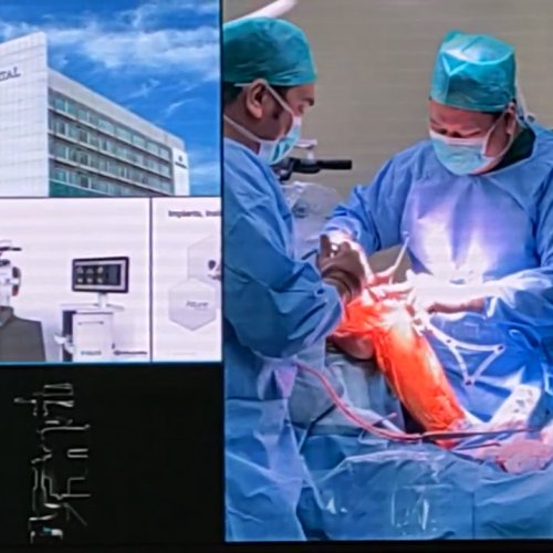 Eka Hospital Jadi Rumah Sakit Pertama Gunakan Teknologi Robotik Penggantian Lutut